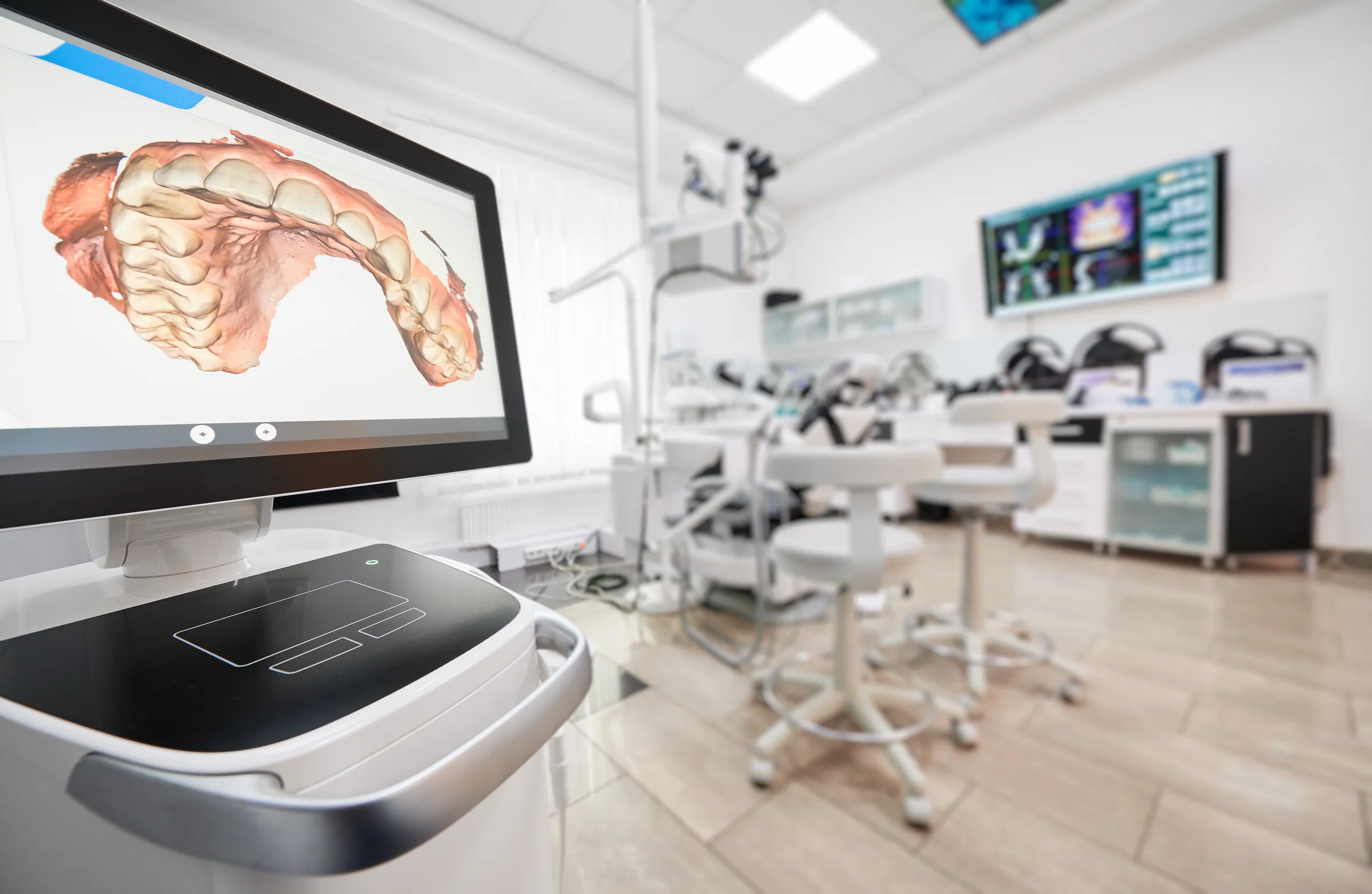 Intraoral scanner monitor displaying a 3D dental arch in a modern treatment room