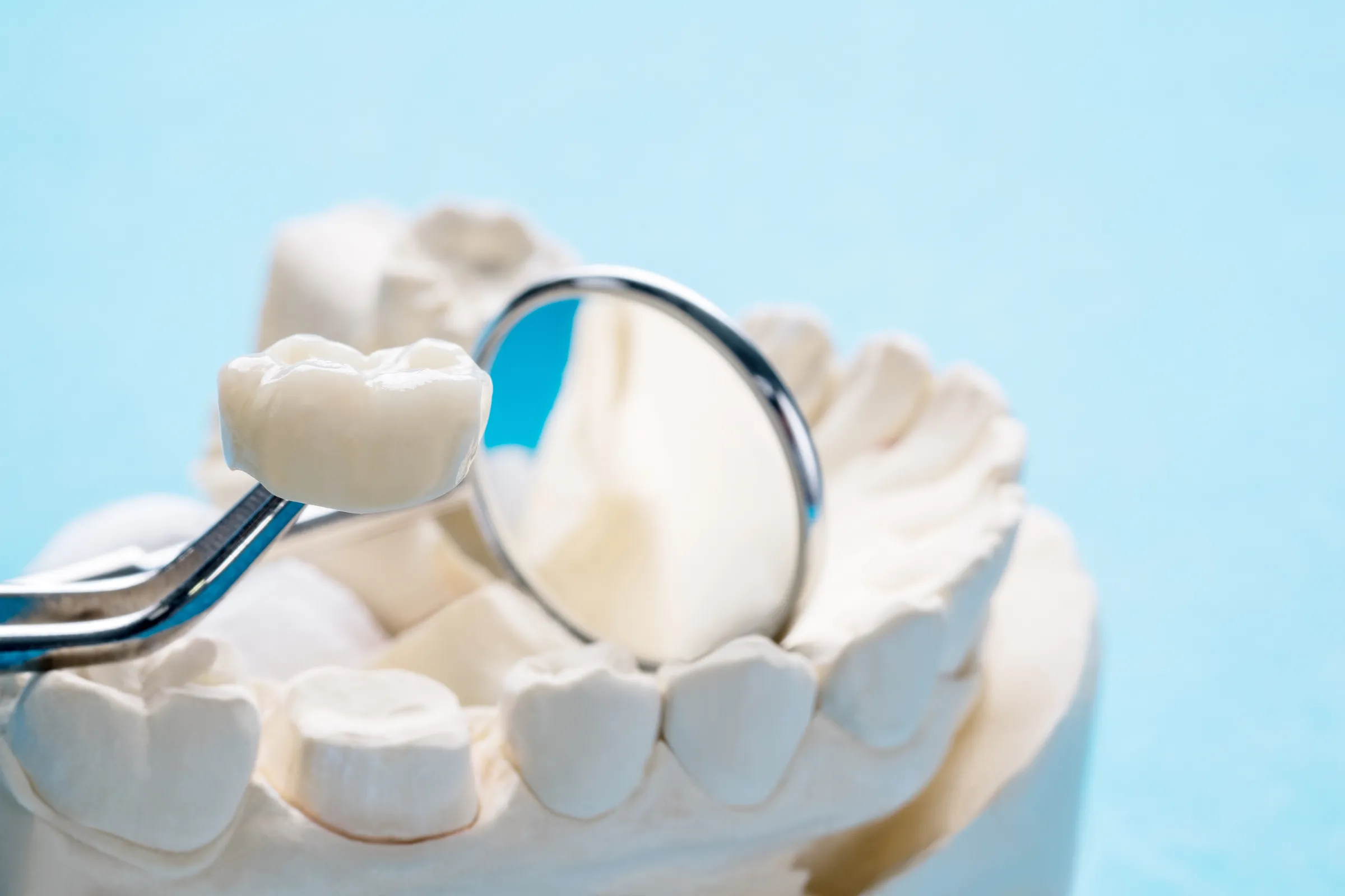 Dental crown on a model of teeth beside a mouth mirror