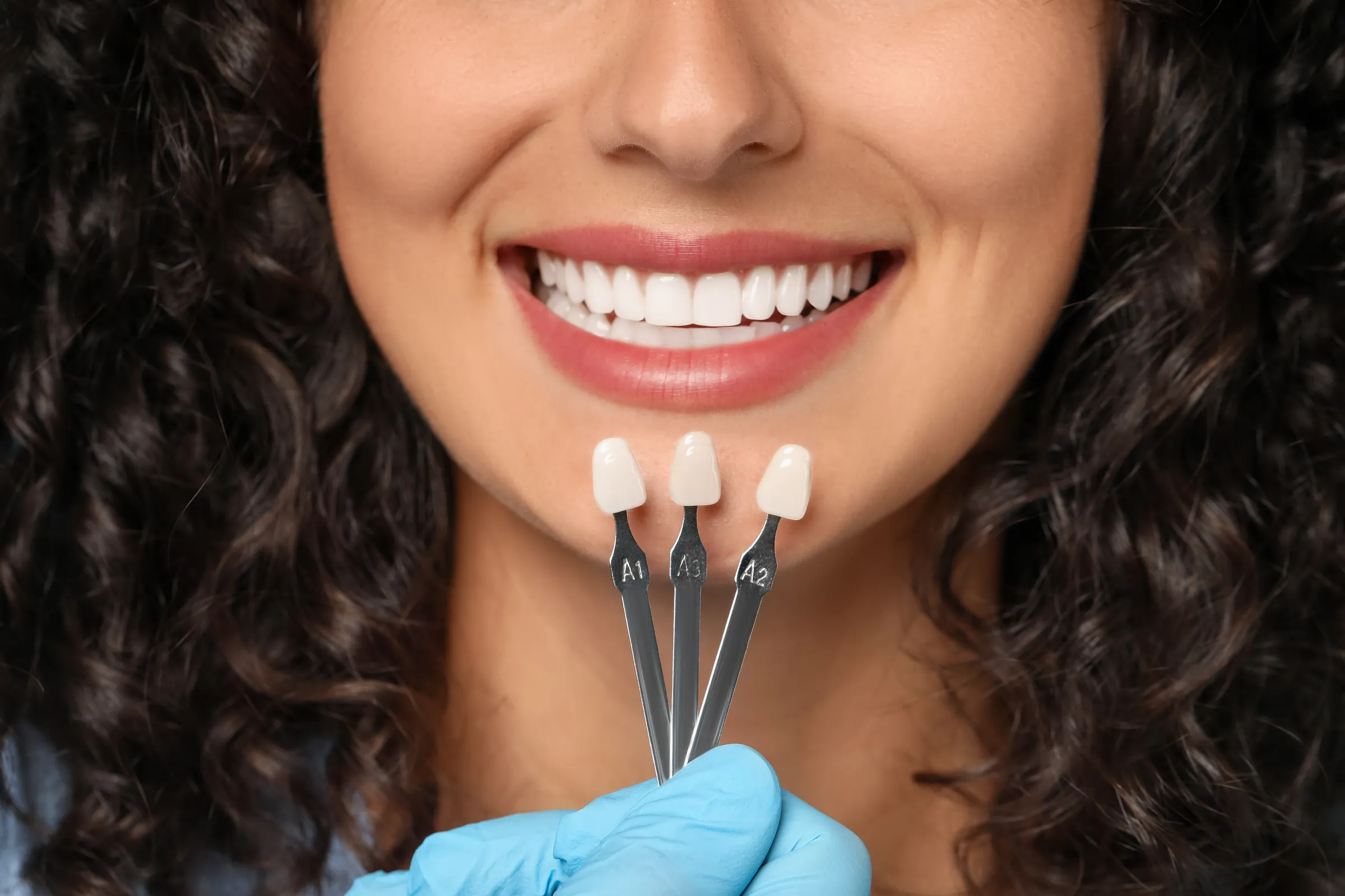 Smiling woman with veneer shade samples held below her chin