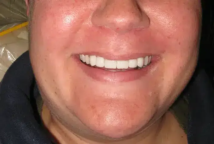 Smile Gallery