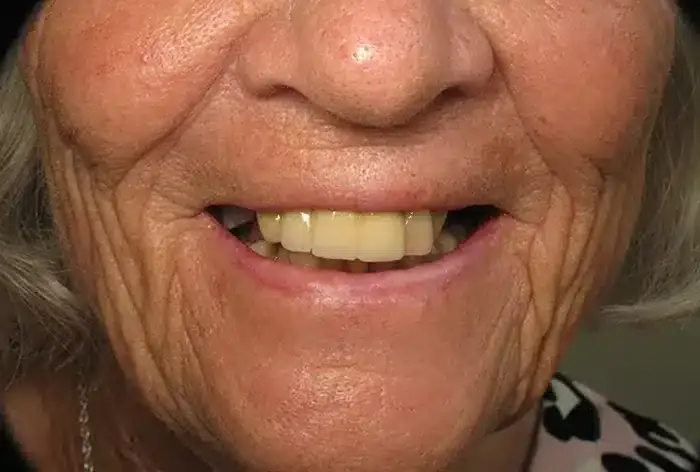 Before treatment