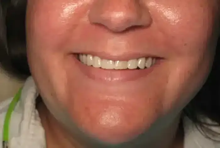 Before treatment